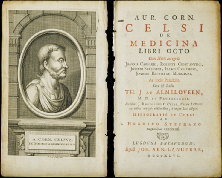 上图：塞尔苏斯（Aulus Cornelius Celsus，主前25-主后50年）编纂的百科全书《医术 De Medicina》。在这本书中提到希腊文称为elephantiasis graecorum的疾病，症状与现代的麻风病相似。但主前3-2世纪的希腊文七十士译本却把「大麻风 צָרַעַת」译为Λέπρα（lepra），意思是「使皮肤有鳞的病」。主后5世纪耶柔米（Jerome）在翻译拉丁文武加大译本时，也没有使用学名elephantiasis graecorum，而是使用lepra的音译，表明他并不认为lepra就是麻风病，而只是一种恶性皮肤病。从lepra转变来的英文leprosy，后来被用来称呼「麻风病 Hansen's Disease」。